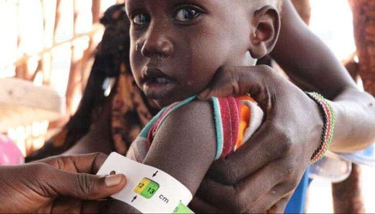 الأطفال في السودان مهددين بالجوع