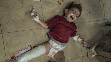 إصابات الأطفال في غزة