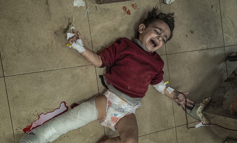 إصابات الأطفال في غزة